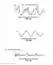 Fig. 05 - Method and apparatus of operating a scanning probe microscope