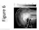 Fig. 07 - METHODS AND DEVICES FOR OPTIMIZATION OF CONTRAST INHOMOGENEITY CORRECTION IN MAGNETIC RESONANCE IMAGING