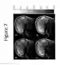 Fig. 08 - METHODS AND DEVICES FOR OPTIMIZATION OF CONTRAST INHOMOGENEITY CORRECTION IN MAGNETIC RESONANCE IMAGING