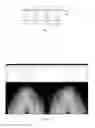Fig. 02 - LIQUID CRYSTAL LENS AND DISPLAY DEVICE