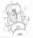 Fig. 07 - Agricultural header with multiple finger infeed assembly
