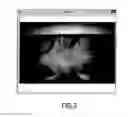 Fig. 03 - SYSTEM FOR TESTING VISUAL FIELD OF A PATIENT AND THE CORRESPONDING METHOD