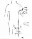 Fig. 07 - WEARABLE MICROWAVE RADIOMETER