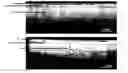 Fig. 01 - Xerostomia Markers