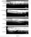 Fig. 02 - Xerostomia Markers