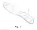 Fig. 02 - Tissue protection system and method