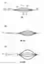 Fig. 02 - Shape memory embolectomy devices and systems