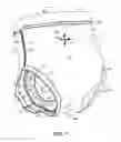 Fig. 02 - Containment pant with attachment mechanisms