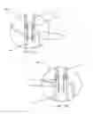 Fig. 12 - Dip tube connectors and pump systems using the same