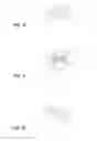 Fig. 04 - Devices and methods for pressure forming connecting webs between workpiece parts of a plate-like workpiece
