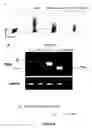 Fig. 07 - Isoform of the TGF-beta receptor II
