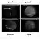 Fig. 05 - Wavelength dispersive microscope spectrofluorometer for characterizing multiple particles simultaneously