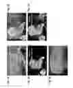 Fig. 02 - METHOD FOR IDENTIFYING AND SELECTING CARDIOMYOCYTES