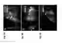Fig. 03 - METHOD FOR IDENTIFYING AND SELECTING CARDIOMYOCYTES