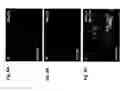 Fig. 07 - METHOD FOR IDENTIFYING AND SELECTING CARDIOMYOCYTES