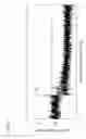 Fig. 07 - Optical probe for optical coherence tomography and manufacturing method therefor