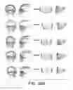 Fig. 35 - Methods and systems for producing an implant