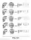 Fig. 49 - Methods and systems for producing an implant