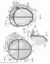 Fig. 04 - HAIR ATTACHMENT