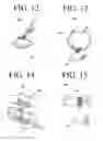 Fig. 08 - Clasp and system