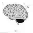 Fig. 02 - Patient reference tool