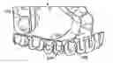 Fig. 01 - Systems and methods for fabricating a dental template