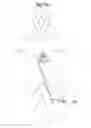 Fig. 49 - Apparatus for treating a heart valve