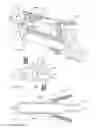Fig. 06 - Methods of fusing a sacroiliac joint