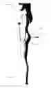 Fig. 34 - Methods of fusing a sacroiliac joint