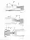 Fig. 44 - Methods of fusing a sacroiliac joint
