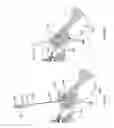Fig. 48 - Methods of fusing a sacroiliac joint