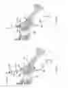 Fig. 49 - Methods of fusing a sacroiliac joint