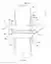 Fig. 74 - Methods of fusing a sacroiliac joint