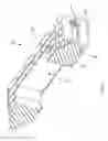 Fig. 82 - Methods of fusing a sacroiliac joint