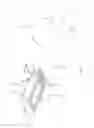Fig. 89 - Methods of fusing a sacroiliac joint