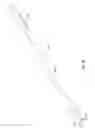 Fig. 90 - Methods of fusing a sacroiliac joint