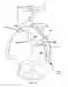 Fig. 92 - Methods of fusing a sacroiliac joint