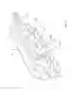 Fig. 96 - Methods of fusing a sacroiliac joint
