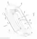 Fig. 98 - Methods of fusing a sacroiliac joint