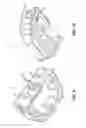 Fig. 09 - Intervertebral implant device