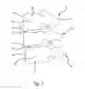 Fig. 02 - Modular anchor bone fusion cage