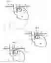 Fig. 02 - APPARATUS FOR TREATING GERD COMPRISING A STIMULATION DEVICE