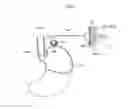 Fig. 45 - APPARATUS FOR TREATING GERD COMPRISING A STIMULATION DEVICE