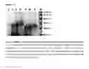 Fig. 04 - METHOD OF PREPARING RECOMBINANT HUMAN TYROSINASE