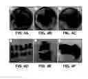 Fig. 06 - UMBILICAL CORD AMNIOTIC MEMBRANE PRODUCTS