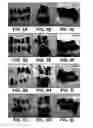 Fig. 07 - UMBILICAL CORD AMNIOTIC MEMBRANE PRODUCTS