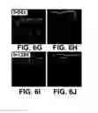 Fig. 09 - UMBILICAL CORD AMNIOTIC MEMBRANE PRODUCTS