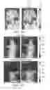 Fig. 08 - METHODS FOR ENHANCING THE DELIVERY OF ACTIVE AGENTS
