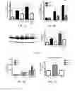 Fig. 02 - IDENTIFICATION AND TREATMENT OF VULNERABLE PLAQUES