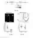 Fig. 06 - IDENTIFICATION AND TREATMENT OF VULNERABLE PLAQUES